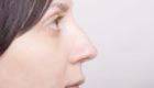超痛い鼻の中のニキビの原因と早く治す5の方法