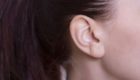 痛いし治らない耳たぶニキビが出来る原因と5つの対処法